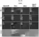 Fig. 17 - METHODS AND COMPOSITIONS FOR REDUCING METASTASES