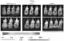Fig. 36 - METHODS AND COMPOSITIONS FOR REDUCING METASTASES