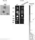 Fig. 37 - METHODS AND COMPOSITIONS FOR REDUCING METASTASES