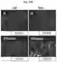 Fig. 38 - METHODS AND COMPOSITIONS FOR REDUCING METASTASES