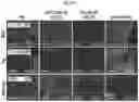 Fig. 50 - METHODS AND COMPOSITIONS FOR REDUCING METASTASES