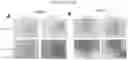 Fig. 10 - ARTIFICIAL T-CELL STIMULATING MATRIX FOR IMMUNOTHERAPY