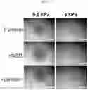 Fig. 11 - ARTIFICIAL T-CELL STIMULATING MATRIX FOR IMMUNOTHERAPY