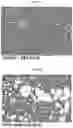Fig. 05 - INFLAMMASOME-TARGETED RNA INTERFERENCE APPROACH TO TREATING KIDNEY INJURY AND DISEASE