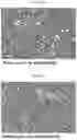 Fig. 06 - INFLAMMASOME-TARGETED RNA INTERFERENCE APPROACH TO TREATING KIDNEY INJURY AND DISEASE