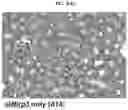Fig. 10 - INFLAMMASOME-TARGETED RNA INTERFERENCE APPROACH TO TREATING KIDNEY INJURY AND DISEASE