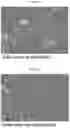 Fig. 12 - INFLAMMASOME-TARGETED RNA INTERFERENCE APPROACH TO TREATING KIDNEY INJURY AND DISEASE