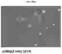 Fig. 13 - INFLAMMASOME-TARGETED RNA INTERFERENCE APPROACH TO TREATING KIDNEY INJURY AND DISEASE