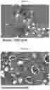 Fig. 14 - INFLAMMASOME-TARGETED RNA INTERFERENCE APPROACH TO TREATING KIDNEY INJURY AND DISEASE