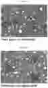 Fig. 15 - INFLAMMASOME-TARGETED RNA INTERFERENCE APPROACH TO TREATING KIDNEY INJURY AND DISEASE