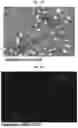 Fig. 16 - INFLAMMASOME-TARGETED RNA INTERFERENCE APPROACH TO TREATING KIDNEY INJURY AND DISEASE