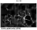 Fig. 17 - INFLAMMASOME-TARGETED RNA INTERFERENCE APPROACH TO TREATING KIDNEY INJURY AND DISEASE