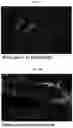 Fig. 18 - INFLAMMASOME-TARGETED RNA INTERFERENCE APPROACH TO TREATING KIDNEY INJURY AND DISEASE