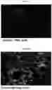 Fig. 23 - INFLAMMASOME-TARGETED RNA INTERFERENCE APPROACH TO TREATING KIDNEY INJURY AND DISEASE