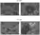 Fig. 32 - INFLAMMASOME-TARGETED RNA INTERFERENCE APPROACH TO TREATING KIDNEY INJURY AND DISEASE