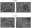 Fig. 33 - INFLAMMASOME-TARGETED RNA INTERFERENCE APPROACH TO TREATING KIDNEY INJURY AND DISEASE