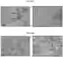 Fig. 35 - INFLAMMASOME-TARGETED RNA INTERFERENCE APPROACH TO TREATING KIDNEY INJURY AND DISEASE