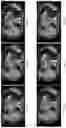 Fig. 09 - TISSUE SPACERS