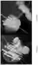 Fig. 14 - TISSUE SPACERS
