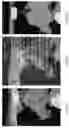 Fig. 18 - TISSUE SPACERS