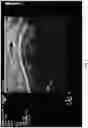 Fig. 10 - Occlusive implant compositions