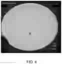 Fig. 05 - VASCULAR EMBOLIC SYSTEM