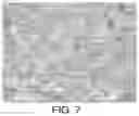Fig. 08 - VASCULAR EMBOLIC SYSTEM