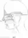 Fig. 06 - BIODEGRADABLE NASAL SPLINT