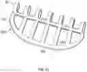 Fig. 08 - BIODEGRADABLE NASAL SPLINT