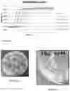 Fig. 34 - COATING COMPRISING ANTI-MICROBIAL PARTICLES, METHODS OF PREPARATION AND USES THEREOF