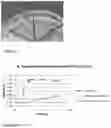 Fig. 35 - COATING COMPRISING ANTI-MICROBIAL PARTICLES, METHODS OF PREPARATION AND USES THEREOF