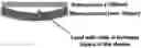 Fig. 01 - CELL ENCAPSULATION DEVICES AND METHODS OF USING SAME