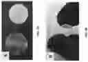 Fig. 04 - CELL ENCAPSULATION DEVICES AND METHODS OF USING SAME