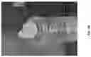 Fig. 08 - CELL ENCAPSULATION DEVICES AND METHODS OF USING SAME