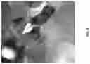 Fig. 12 - CELL ENCAPSULATION DEVICES AND METHODS OF USING SAME