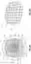 Fig. 05 - OBTURATOR, METHODS OF FORMING A PREFABRICATED, INNERVATED, PRE-VASCULARIZED, PRELAMINATED (PIPP) FLAP USING AN OBTURATOR TO MAINTAIN A STOMA OR LUMEN, AND METHODS OF RESTORING DAMAGED OR SURGICALLY-REMOVED SOFT TISSUE WITH A PIPP FREE OR ROTATIONAL FLAP