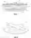 Fig. 08 - OBTURATOR, METHODS OF FORMING A PREFABRICATED, INNERVATED, PRE-VASCULARIZED, PRELAMINATED (PIPP) FLAP USING AN OBTURATOR TO MAINTAIN A STOMA OR LUMEN, AND METHODS OF RESTORING DAMAGED OR SURGICALLY-REMOVED SOFT TISSUE WITH A PIPP FREE OR ROTATIONAL FLAP