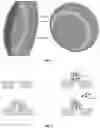 Fig. 06 - ENZYME-DEGRADABLE HYDROGEL FOR DELIVERY OF A PAYLOAD