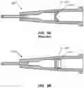 Fig. 09 - Antimicrobial inserts for medical devices