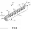 Fig. 03 - Sleeve for medical device assembly