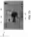 Fig. 18 - EXHAUST BLOCKAGE DETECTION FOR NEGATIVE PRESSURE WOUND TREATMENT APPARATUSES