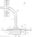 Fig. 01 - Negative pressure wound therapy system with dynamic fluid delivery