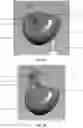 Fig. 03 - EAR IRRIGATING DEVICE