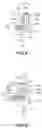 Fig. 09 - UNILATERALLY DRIVEN DRUG INFUSION DEVICE WITH MULTIPLE INFUSION MODES