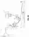 Fig. 05 - SURGICAL GAS SUPPLY PRESSURE SENSING