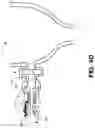 Fig. 11 - SURGICAL GAS SUPPLY PRESSURE SENSING