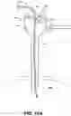 Fig. 33 - SURGICAL GAS SUPPLY PRESSURE SENSING