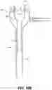 Fig. 34 - SURGICAL GAS SUPPLY PRESSURE SENSING