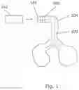 Fig. 02 - A METHOD AND A DEVICE FOR ESTIMATING AN AMOUNT OF A POWDER SHAPED MATERIAL PASSING A BEND IN A FLOW CHANNEL