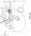 Fig. 14 - Intubation system, method, and device